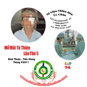 Mổ mắt đợt 6